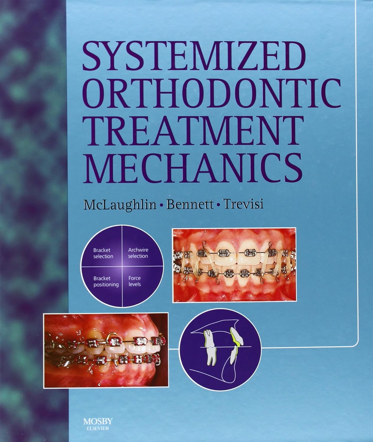 Systemized Orthodontic Treatment Mechanics